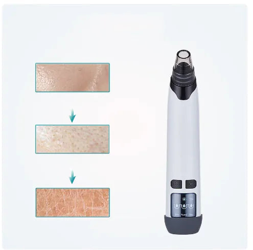 “ClearSkin Vacuum Tool”